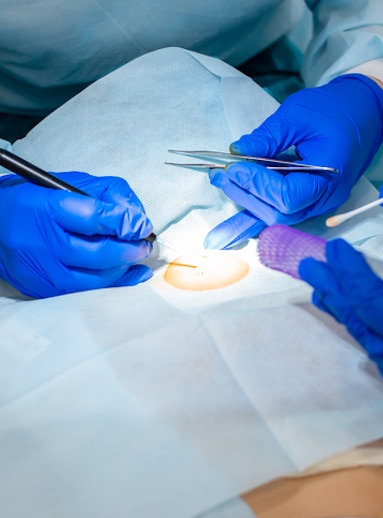 The surgeon does surgery to remove the mole on the patient's back. The process of burning moles in a private clinic to remove moles